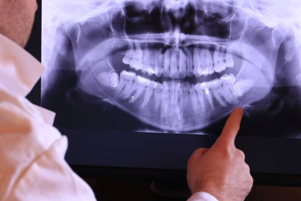 Best Emergency Treatment for Dental Infections or Abscesses in Clear Lake, IA