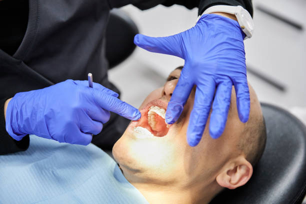 Best Emergency Tooth Extraction in Clear Lake, IA