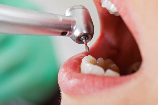 Best Urgent Care for Lost Fillings or Crowns in Clear Lake, IA